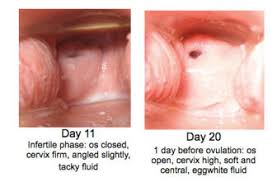 The mucosa is made up of specialized. Self Exam The Cervix Close Up Our Bodies Ourselves