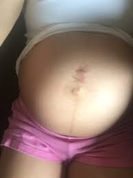 Belly Button Piercing After Pregnancy Scar