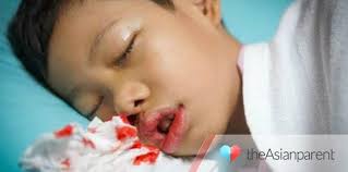 Hangpa semua mesti dok tunggu kan video nieh. Hidung Berdarah Pada Anak Adakah Ia Tanda Berbahaya Theasianparent Malaysia
