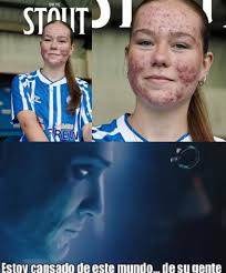 Con solo 16 años, la futbolista escocesa Skye Stout firmó su primer  contrato profesional con el Kilmarnock FC, el segundo club más antiguo de  Escocia. ⚽🇬🇧 Pero en lugar de celebrarse su