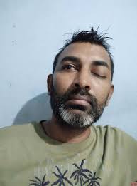 Assistance for Brain Surgery