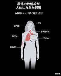 7月16日に原爆の実験が成功し 7月25日にポツダム宣言、日本が それを拒否し、わずか10日ほど経った 8月6日に広島、8月9日に長崎への 原爆投下という流れとなります。 å¿«æ™´ã®æœãŒãŸã¡ã¾ã¡åœ°ç„ã« ãƒªãƒˆãƒ«ãƒœãƒ¼ã‚¤ã¨ãƒ•ã‚¡ãƒƒãƒˆãƒžãƒ³ã®æŠ•ä¸‹ã‹ã‚‰75å¹´ Bbcãƒ‹ãƒ¥ãƒ¼ã‚¹
