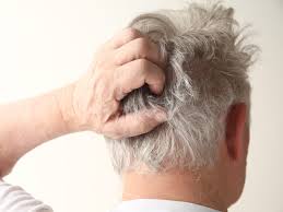 Itchy Scalp: Causes, Treatment, Prevention