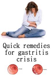 Quick Remedies For Gastritis Crisis Ladies Grace Remedies For Gastritis Gastric Problem Home Remedies Home Remedies For Gastritis