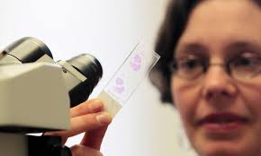 Colon Cancer Prevention Program Available Provincewide