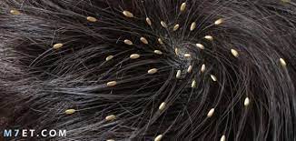 لندن الذهاب لمشاهدة معالم المدينة لسان التخلص من بيض القمل في المنزل findlocal drivewayrepair com