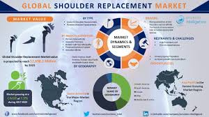 Advancements In Shoulder Replacements Laid The Path To The New Procedures Where The Ball Is Preserved And Re Marketing Replacement Reverse Shoulder Replacement