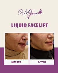 Dr Mohamed Fathi (@dr.mohamed.fathi.derma) · Instagram 照片和视频