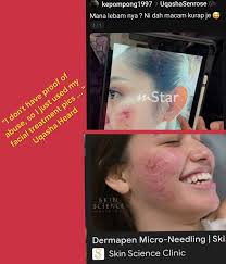 Kenapa ramai laki nak pukul uqasha ni 🥹