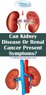Kidney Cleanse Link Polycystic Kidney Disease Kidney Disease Symptoms Kidney Dialysis