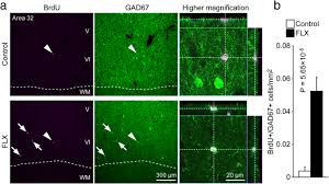 Until recently, scientists assumed they knew how fluoxetine/prozac worked. Fluoxetine Induced Dematuration Of Hippocampal Neurons And Adult Cortical Neurogenesis In The Common Marmoset Molecular Brain Full Text