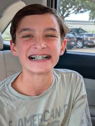 Well we just put our 3rd kid in braces!! 😄🤣🤪 Yeah it's like a whole  house payment now!! #crazykleinadventure #braces #teenagerslife