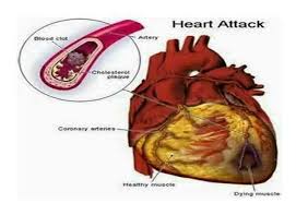 Hadkan lemak tepu dan lemak trans dan gantikannya dengan lemak yang lebih baik, tak tepu. Usana Kota Makanan Jantung Tersumbat Facebook