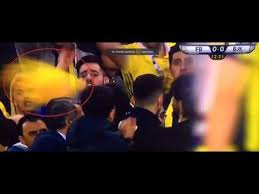 Şenol güneş'in kafasına atılan şenol güneş'i̇n kafası yarıldı hemen hastaneye kaldırıldı kafasına deyen yabancı cisim bu. Senol Gunes In Kafasina Atilan Yabanci Cisim Bu Durum Ciddi Youtube