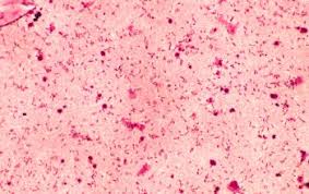 Image result for Rhizobium radiobacter, syn. Agrobacterium tumefaciens