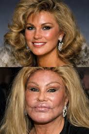 التجميل خيار شخصي لأسباب شخصية ‏‎##جراحة_تجميل #جدة #السعودية #صحتك #ثقة  #تجميل_الجسم #jeddah#beauty #selflove #plasticsurgery#plasticsurgeon  #drsamahabed #دسماح_عابد