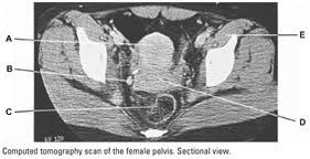 Other pelvic muscles, such as the psoas major and iliacus, serve as flexors. Anatomy Pre U Assignments For Exam 2 Pelvis Pelvic Girdle Flashcards Quizlet