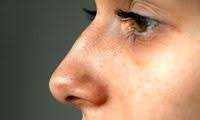 برچسب: قوز بینی