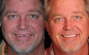 Family Dental Care in Flagstaff, Cottonwood, and Sedona