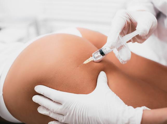 Brazilian Non Surgical Butt Lift |The Cosmetic Lounge