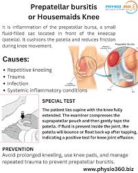 Image result for Prepatellar Bursitis