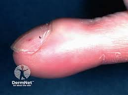 Image result for Digital Clubbing