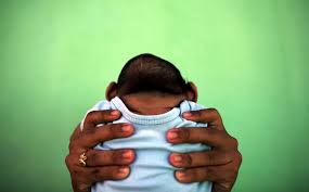 Here's the secret trick for little doll parents: 4 In 10 Babies Born After Zika Infection May Have Brain Defects Researchers Say Pbs Newshour