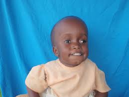 Success! Loveness from Tanzania raised $775 for surgery to treat  hydrocephalus.