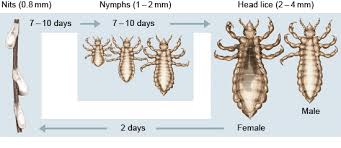 Head lice like to stay where it is warm so checking behind your ears and the nape. How Can Head Lice Be Treated Informedhealth Org