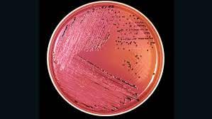 Federal health officials say an outbreak of salmonella infecting nearly 400 people in more than 30 states has been linked to red onions, and identified a california company as the. Salmonella Outbreak In 31 States Linked To Red Onions Cnn