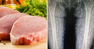 We did not find results for: Hobi Makan Daging Mentah Tubuh Wanita Ini Dipenuhi Cacing