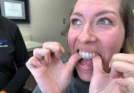 If you wear invisalign® aligners, you have no doubt heard about their cleaning system and its packets of cleaning crystals. How To Care For Invisalign Aligners Proper Use