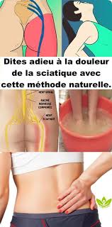 Dites Adieu A La Douleur De La Sciatique Avec Cette Methode Naturelle Bien Etre Sciatique Nerf Sciatique Et Remede Sciatique