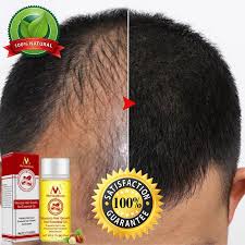 You can also take a daily biotin supplement, which will give your hair the vitamin b it needs to to learn more about how to adjust your diet to help promote hair growth, keep reading! Magical Hair Growth Oil Original Faster Hair Loss Treatment Guaranteed Results Ebay