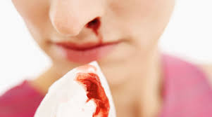 < getah sabah harga getah sekilo hari ini hala tuju selepas stpm harga bahan binaan 2019 guardian health and beauty sdn bhd harapan untuk masa depan malaysia yang lebih cemerlang harga buah durian musang king per kilo haiwan di dalam laut gendang ibu dan anak. Tahukah Anda Bahawa Kerap Berlaku Pendarahan Dan Hidung Tersumbat Adalah Salah Satu Simptom Penyakit Kanser Daily Rakyat