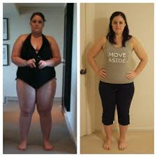 Pin On Bariatric Surgery