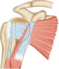 Ligaments are soft tissue structures that connect bones to bones. Conjoint Or Conjoined Tendon Shoulder