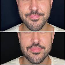 Dra. Alejandra Jara (@dra.jara_maquilon) • Instagram photos and videos