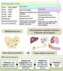 Multiple myeloma is a blood cancer affecting plasma cells. Extramedullary Multiple Myeloma Leukemia X Mol