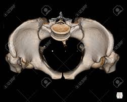 The gastrocnemius muscle is a complex muscle that is fundamental for walking and posture. Ct Scan Pelvis Bone 3d Rendering Image Isolated On Black Background Stock Photo Picture And Royalty Free Image Image 150215233