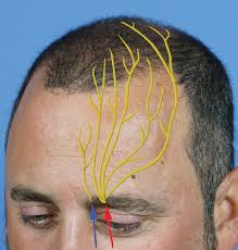 Image result for Forehead Regional Block