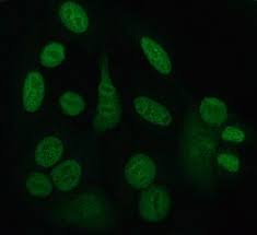 Image result for ANA Staining Pattern