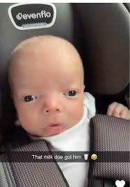 Craniodiaphyseal Dysplasia Kayla