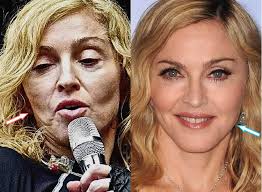 Plastic surgery might not only help make people look younger or more attractive. Did Madonna Ever Have Plastic Surgery Before After 2021