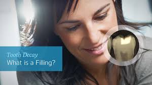 Dental Bonding in Destin