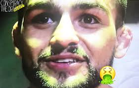 Kelvin gastelum sub wins 4 decisions wins 5 рост 175 см размах рук 180 см вес 83 кг возраст 28 ufc №7 средний вес борьба, бокс, бжж. What In The Ring Worm Staph Is Growing On Kelvin Gastelum S Face