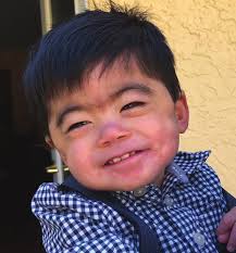 COVID-19 Vaccine and Individuals with CdLS Palliative Care Benefits