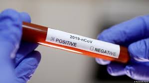 Hasil Rapid Test Di Dki Jakarta 121 Positif Dan 10 338 Negatif