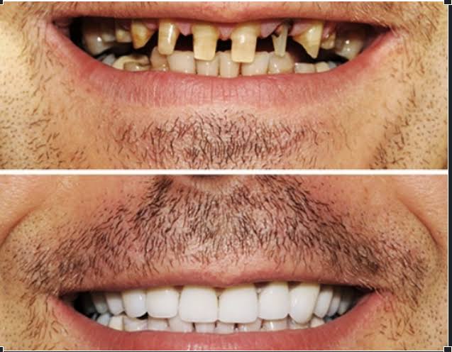 Restorative Dentistry product image