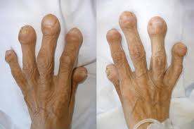 Image result for Digital Clubbing